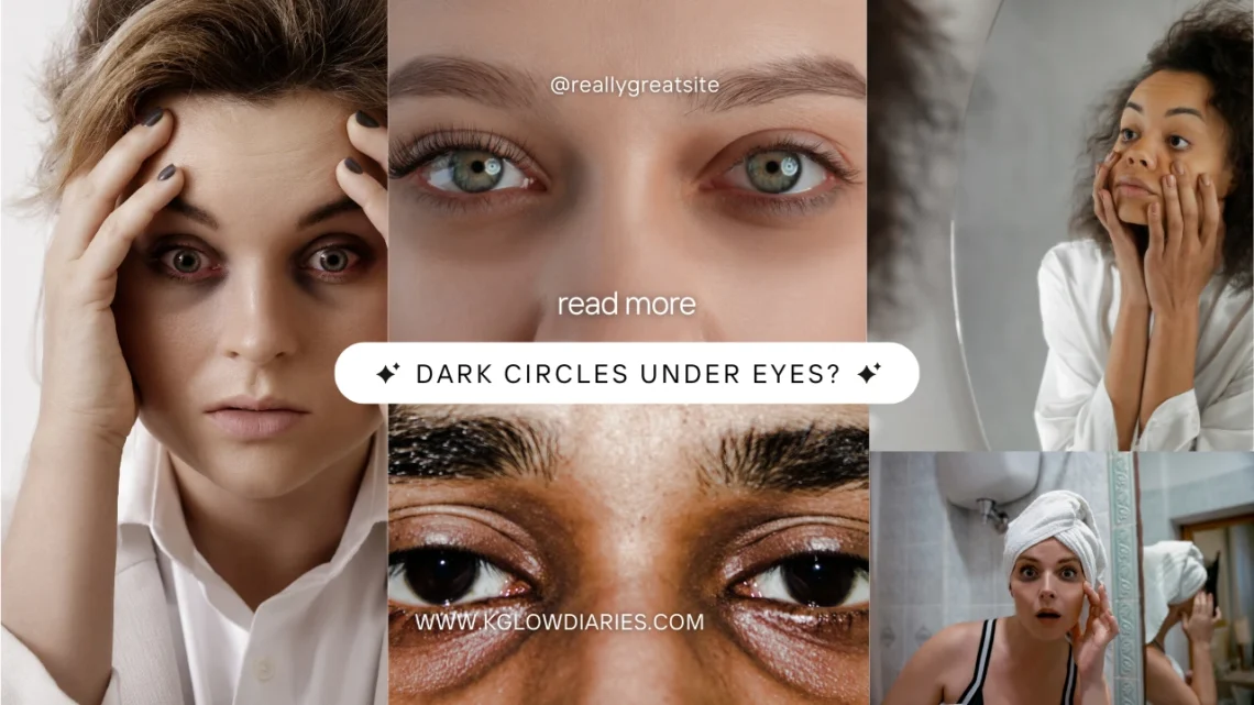 A collage of five images showing different people with visible dark circles or puffiness under their eyes; center text reads "DARK CIRCLES UNDER EYES?" with the website www.kglowdiaries.com.