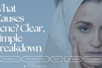 A woman with a towel on her head touching a blemish on her face; text overlay reads "What Causes Acne? Clear, Simple Breakdown" with tags for "Dirty pillowcases," "Fluctuating Hormones," "Stress," "Unhealthy Diet," and "Over exfoliation."