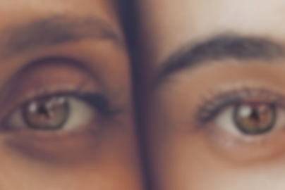 What Causes Dark Circles Under Eyes? Scientific Explanation