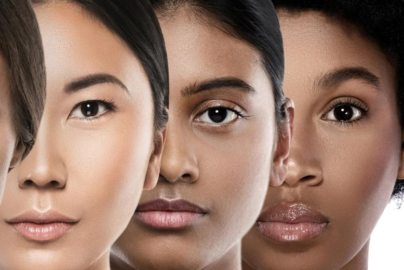 What Is Your Skin Type? Complete Beginner-Friendly Explanation