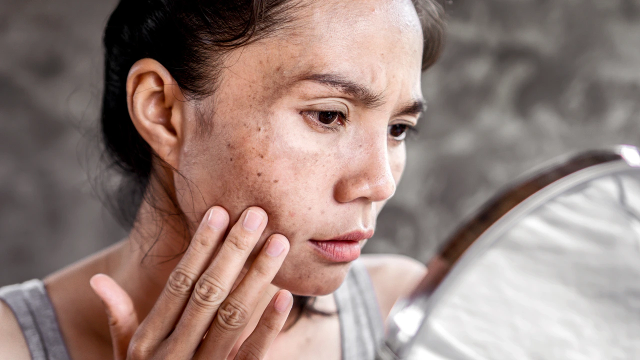 A close-up of a woman looking intently into a mirror while touching a area of dark, uneven skin tone on her cheek.