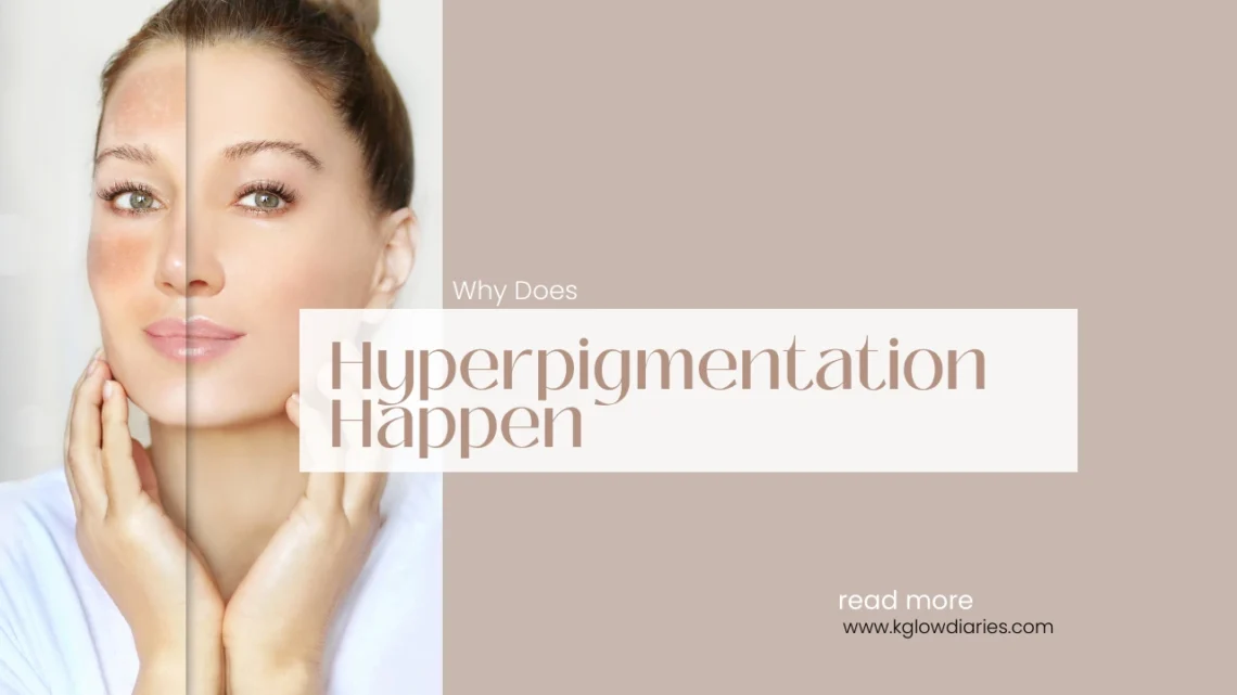 A side-by-side comparison of a woman's face, with one side showing darker patches of skin; text overlay reads "Why Does Hyperpigmentation Happen".