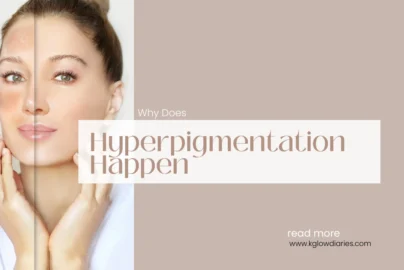 A side-by-side comparison of a woman's face, with one side showing darker patches of skin; text overlay reads "Why Does Hyperpigmentation Happen".