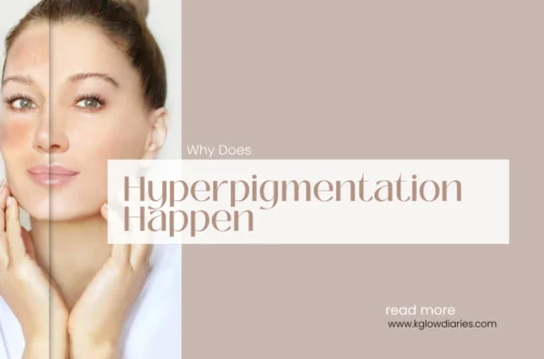 A side-by-side comparison of a woman's face, with one side showing darker patches of skin; text overlay reads "Why Does Hyperpigmentation Happen".