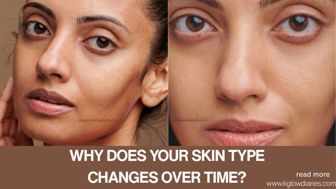 A side-by-side comparison of a person's face showing different skin textures. Text at the bottom asks "WHY DOES YOUR SKIN TYPE CHANGES OVER TIME?" with the website www.kglowdiaries.com.