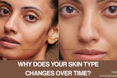 A side-by-side comparison of a person's face showing different skin textures. Text at the bottom asks "WHY DOES YOUR SKIN TYPE CHANGES OVER TIME?" with the website www.kglowdiaries.com.