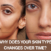 A side-by-side comparison of a person's face showing different skin textures. Text at the bottom asks "WHY DOES YOUR SKIN TYPE CHANGES OVER TIME?" with the website www.kglowdiaries.com.