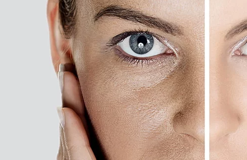 Why Does Skin Look Dull? Main Causes Explained