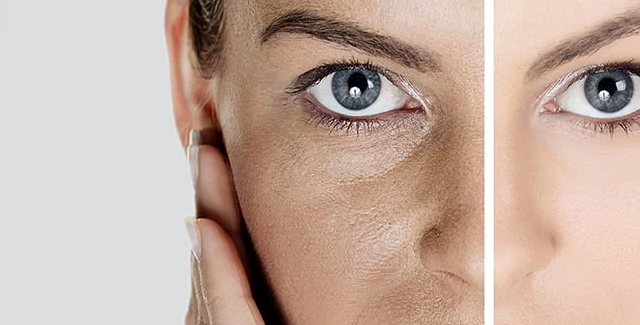 Why Does Skin Look Dull? Main Causes Explained