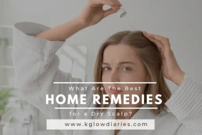 The image shows a woman with shoulder-length brown hair wearing a white textured bathrobe, looking directly at the camera with a neutral expression. She is holding a glass dropper over her head, applying a clear liquid to her scalp while using her other hand to part her hair. In the center of the image, there is a large text overlay that reads: What Are The Best HOME REMEDIES for a Dry Scalp? www.kglowdiaries.com