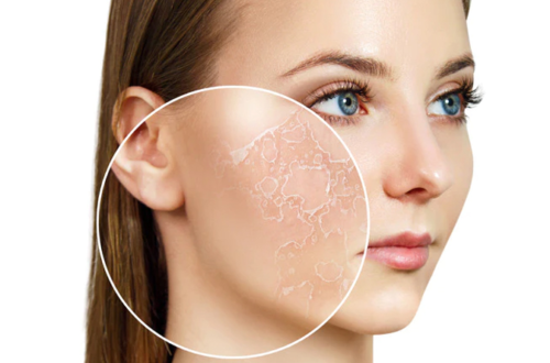 How to Build a Skincare Routine for Dry Skin