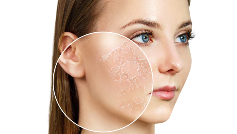 How to Build a Skincare Routine for Dry Skin