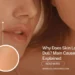 A wide banner featuring three women with glowing skin titled "WHAT IS Your Skin Type?". One woman applies cream to her face, while another has dots of product on her cheek. The website URL www.kglowdiaries.com is displayed at the bottom.