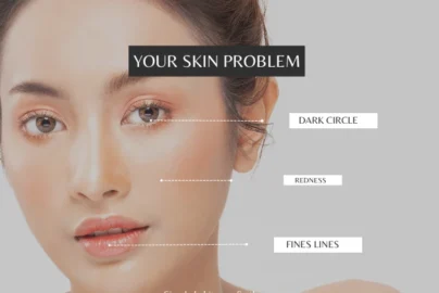 A close-up photo of a woman's face labeled "YOUR SKIN PROBLEM." Dotted lines point to specific areas of concern including Dark Circles under the eyes, Redness on the cheek, and Fine Lines around the mouth. The bottom text asks, "Is the 60-Second Rule Suitable for All Skin Types?".