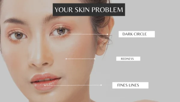 What Is Your Skin Type? Complete Beginner-Friendly Explanation